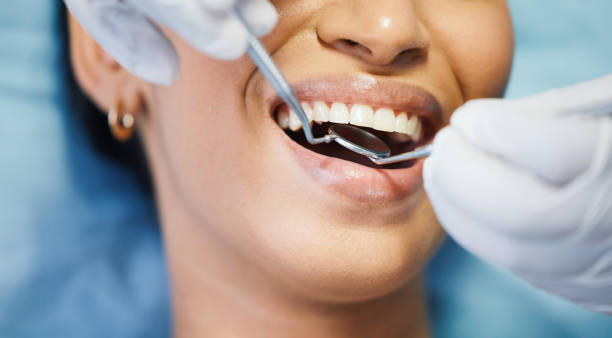 Best Emergency Dentist for Special Needs Patients in Soh Jordan, UT